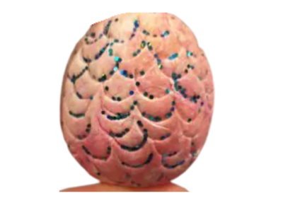 dragon egg